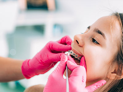 Pediatric Dental Care in Carlsbad