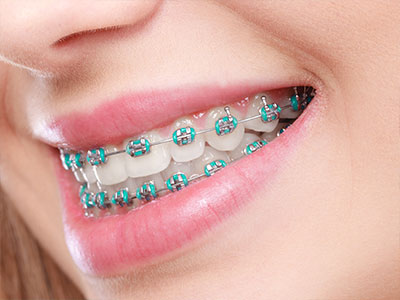 Carlsbad Children s Orthodontics