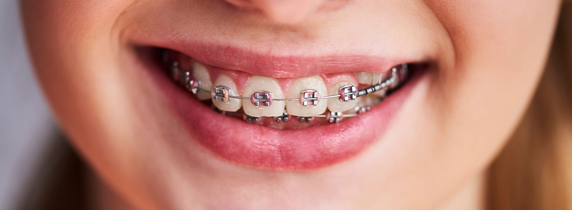 Carlsbad Children   s Dentist