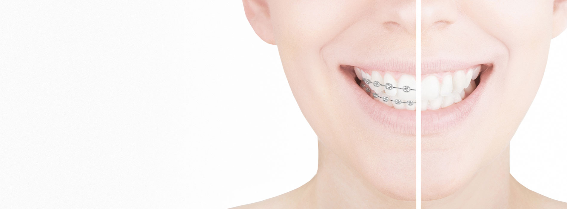 Pediatric Dentist in Solana Beach